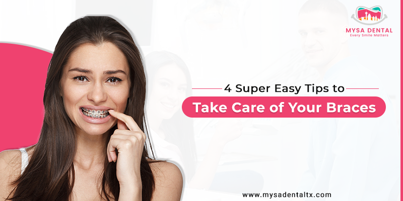 Super Easy Tips to Take Care of Your Braces