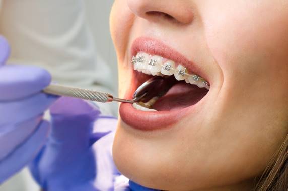 What Does an Orthodontist Do? A Comprehensive Guide to Orthodontic Care